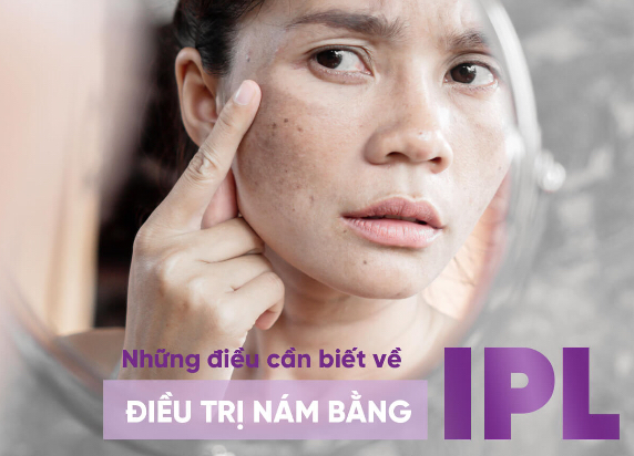 điều trị nám bằng IPL