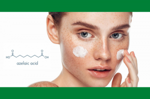 Cách điều trị nám bằng Azelaic Acid cho người mới bắt đầu & Lưu ý khi dùng