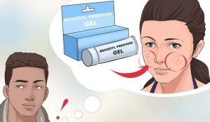 Cách sử dụng Benzoyl Peroxide trị mụn hiệu quả