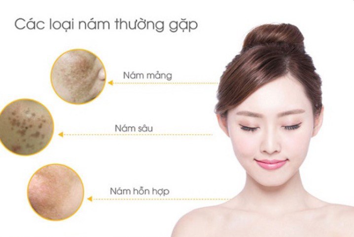 nam-da-7-cach-phong-ngua-nam-da-hieu-qua