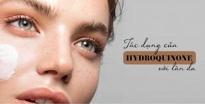 HYDROQUINONE LÀ GÌ? CÔNG DỤNG & TÁC DỤNG TRONG ĐIỀU TRỊ NÁM