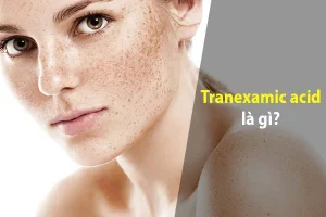 tranexamic acid