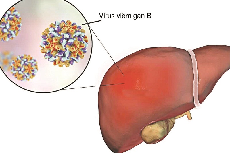 Những bệnh đường tình dục được ngăn ngừa nhờ tiêm vaccine?