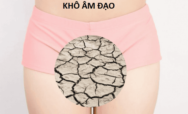 5 lời khuyên cho chị em sau sinh bị khô hạn từ bác sĩ