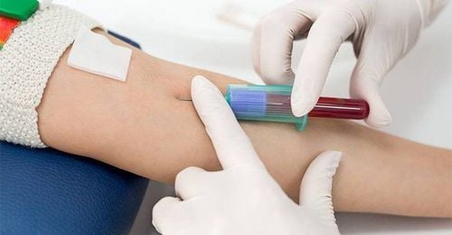 Tránh nhầm lẫn mụn HIV với mụn thông thường