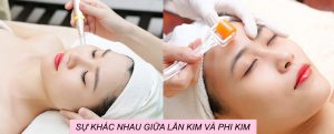 Phân biệt lăn kim và phi kim khác nhau như thế nào?