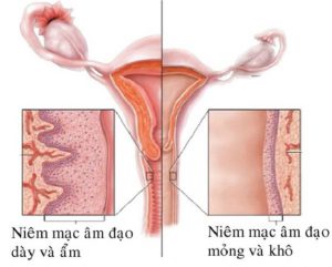 Có thể làm chậm quá trình teo âm đạo không?