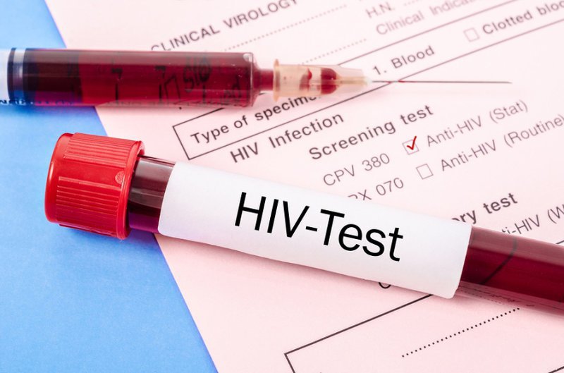 Gợi ý thời gian xét nghiệm HIV để có kết quả chính xác