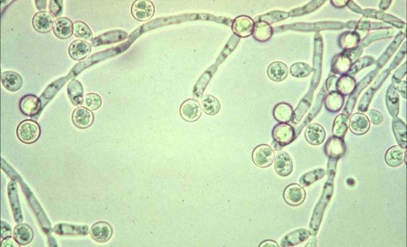 Dấu hiệu nhiễm nấm candida và những điều bạn cần biết!