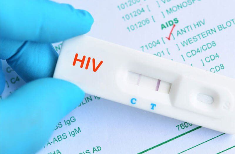 Gợi ý thời gian xét nghiệm HIV để có kết quả chính xác