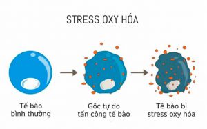 7-nguy-co-dan-den-stress-oxy-hoa-ma-ban-nen-biet