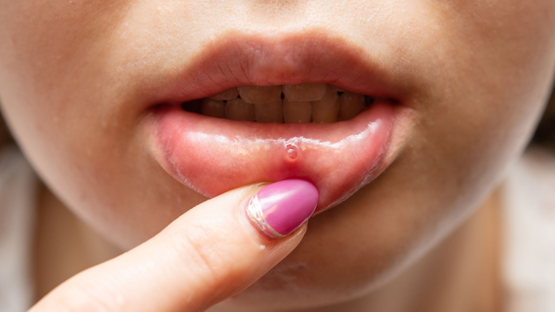 7 nhóm người không nên ăn gạo nếp