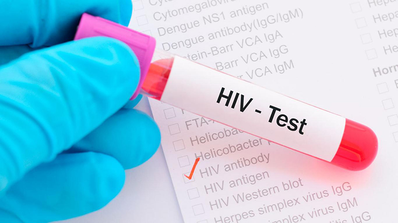 Dùng thuốc kháng vi rút sớm, tăng cơ hội sống cho người có HIV