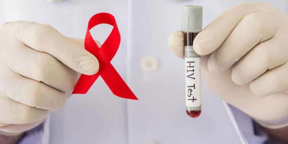 Tìm hiểu nguyên nhân dương tính giả HIV