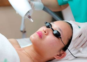 Laser là gì? Ứng dụng của tia laser trong thẩm mỹ, y học