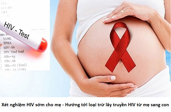 Gợi ý thời gian xét nghiệm HIV để có kết quả chính xác